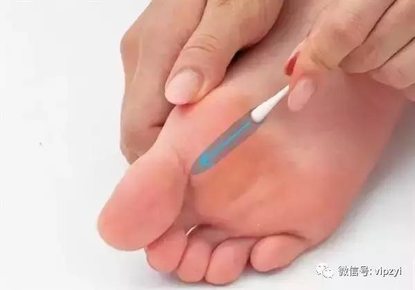 肩颈病的最好治疗方法,肩颈病最好的治疗方法