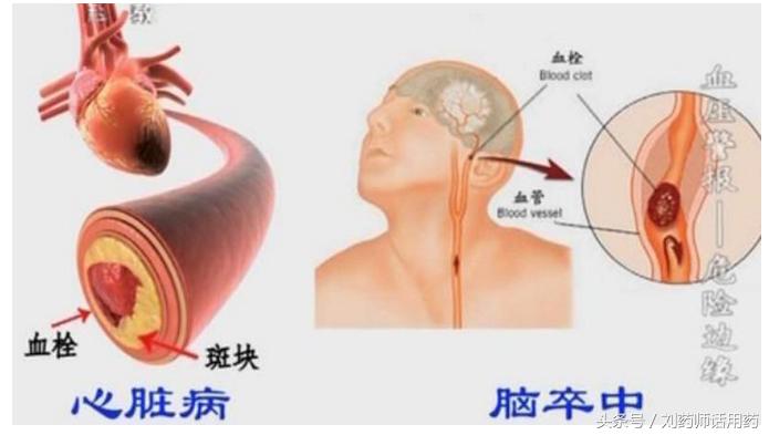 空腹血糖高吃什么来降血糖,空腹血糖高了怎么办如何降糖