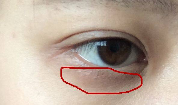 国庆小长假,正是悄悄变美的好时机,拒绝熊猫眼,你是哪种类型?