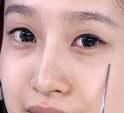 国庆小长假,正是悄悄变美的好时机,拒绝熊猫眼,你是哪种类型?