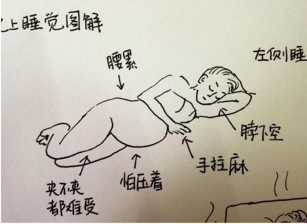 孕期胎儿缺氧哪些表现,孕期胎儿缺氧是什么原因