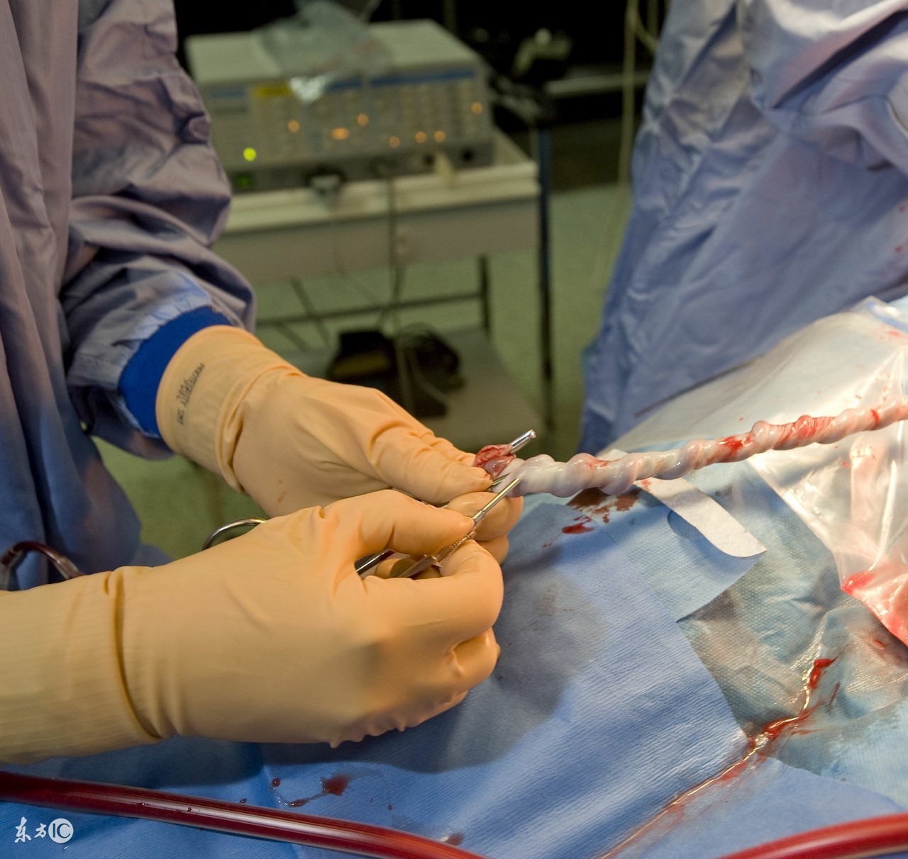 孕30周还能做脐带血穿刺吗,孕24周做羊水穿刺危险吗