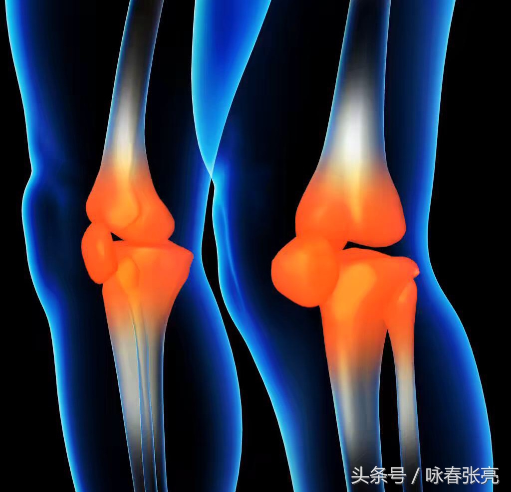 咏春拳十大杀招图解,咏春拳击打颈部招数