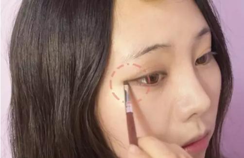 眼角鼻梁塌怎么拯救,鼻梁塌陷怎么补救不手术