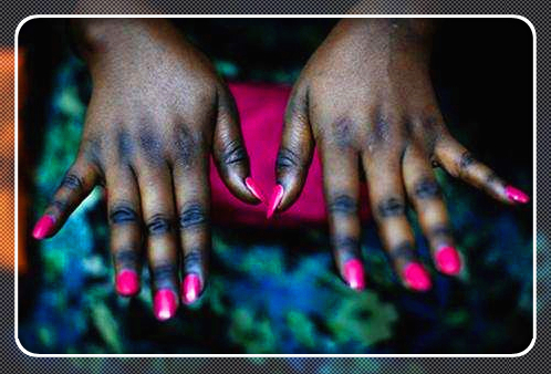 这种方法比整容还猛，非洲黑人女孩流行把全身肌肤漂白！