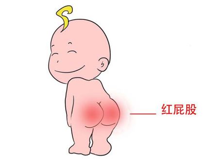 宝宝预防红屁屁膏推荐,防宝宝屁股红神器