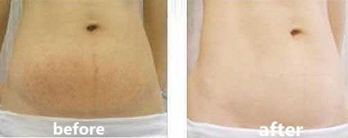 深扒那些爆火的网红减肥法,深扒8种抗衰老成分