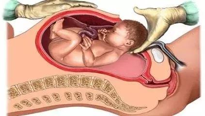 胎儿无影脚,胎儿恐怖成像