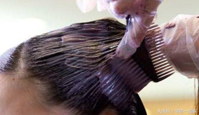 美发师孕期接触染发剂新生儿畸形