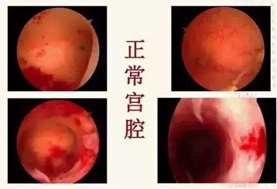 有哪些不良症状要做宫腔镜检查,一般什么情况才会做宫腔镜检查