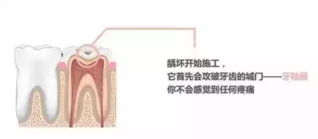 同样是补牙价格为什么差很远,同样补牙为什么报销不一样