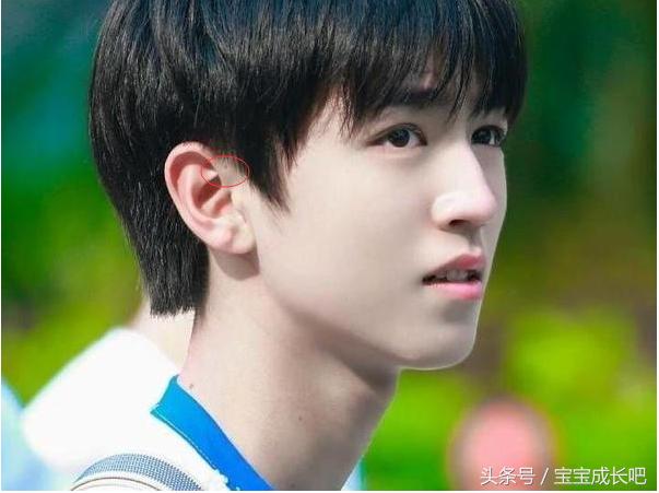 小孩子耳朵有个小小洞,小孩耳朵上方有个小孔是什么原因