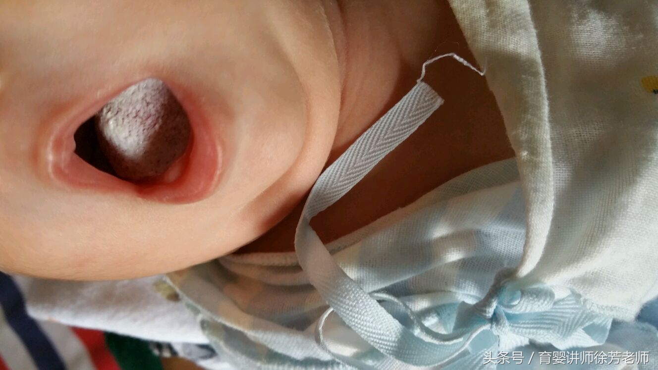 宝宝嘴巴上面白白的是怎么回事,宝宝嘴巴里面白白的是怎么回事