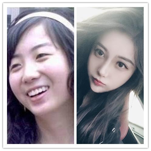 全网整容最成功的网红,全网前十网红整容