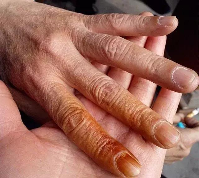 你可能需要的是替烟而不是戒烟（*子烟电**篇）