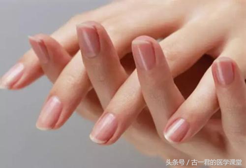 支气管扩张是大病吗,支气管扩张