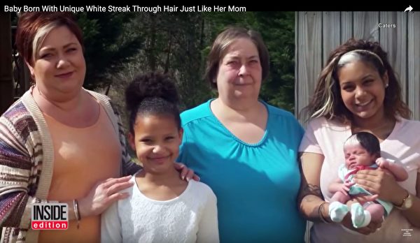 新生婴儿头顶白发,宝宝刚出生有几根白发