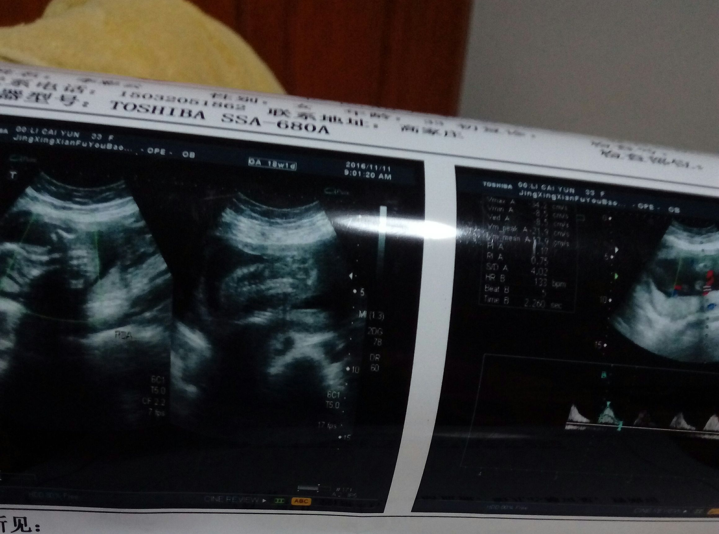 在什么样的情况下才能快速怀孕,什么情况影响生育