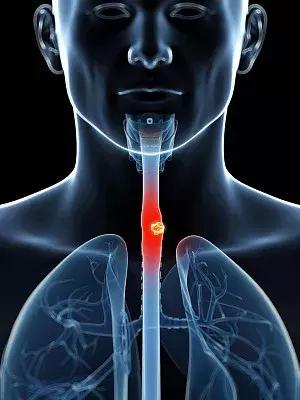 爱喝白酒的人吃东西下咽费劲,爱喝白酒的危害