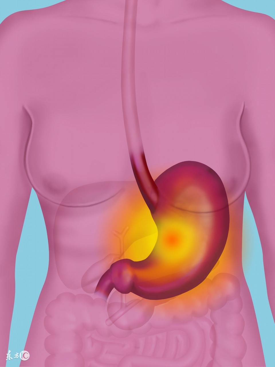 依卡倍特钠颗粒可以修复胃粘膜吗 (服用依卡倍特钠颗粒对胃有刺激吗)