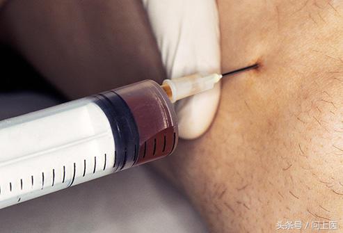 老年人膝盖疼痛的原因和治疗方法,膝盖疼痛的原因和解决方法