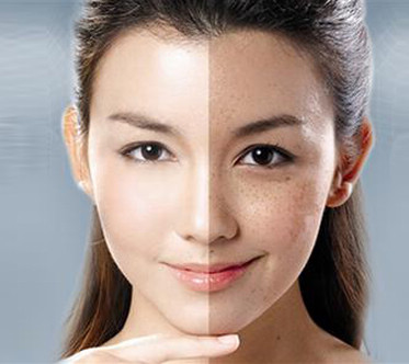 40多岁女性脸上斑多是怎么回事,40岁长斑的女性吃什么祛斑最好