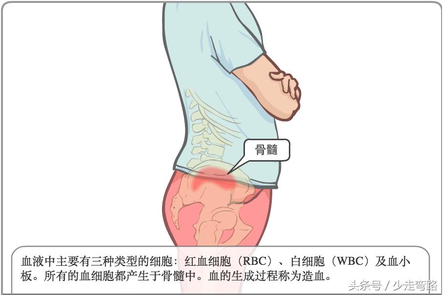 急性淋巴细胞白血病定义,小儿急性淋巴细胞性白血病