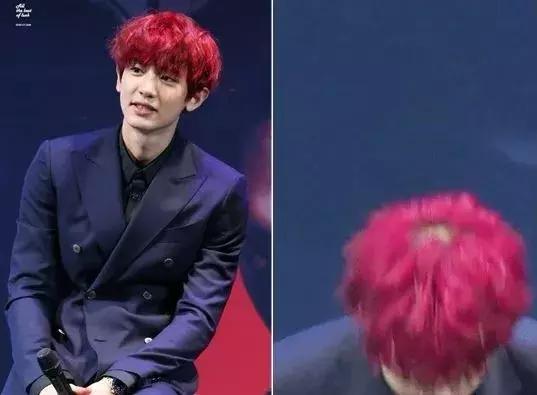 总是担心自己要秃了,怀疑自己越来越秃