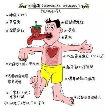 小孩会得心梗是怎么回事,小孩会突发心梗吗