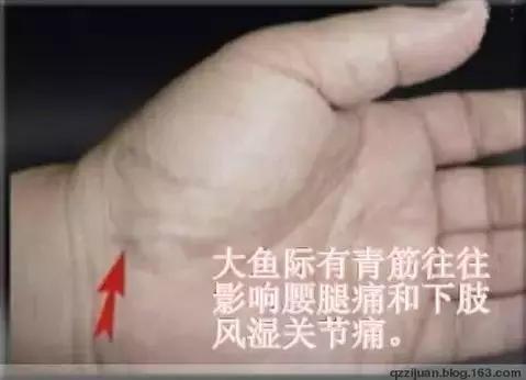 各类青筋的分布和原因,治爆青筋的中药方法