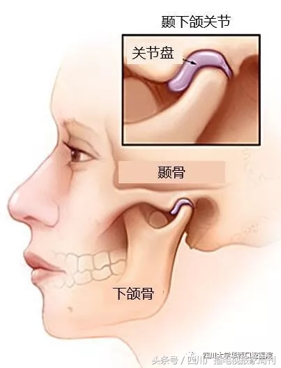 嘴巴张不开是为啥,牙疼嘴巴张不开是什么原因