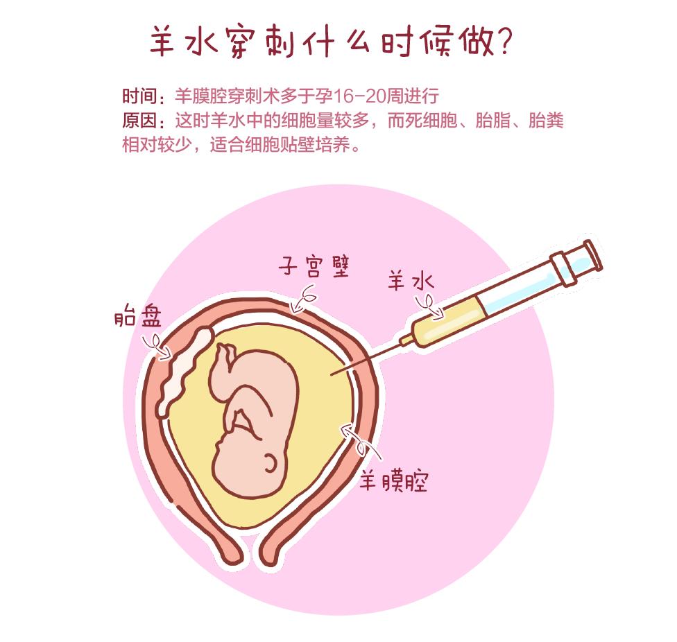 怀孕医院检查唐氏筛查有异常,孕期做唐氏筛查要注意些什么