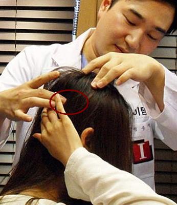 后脑勺凸起头型不好看如何矫正,什么头型让后脑勺凸起来