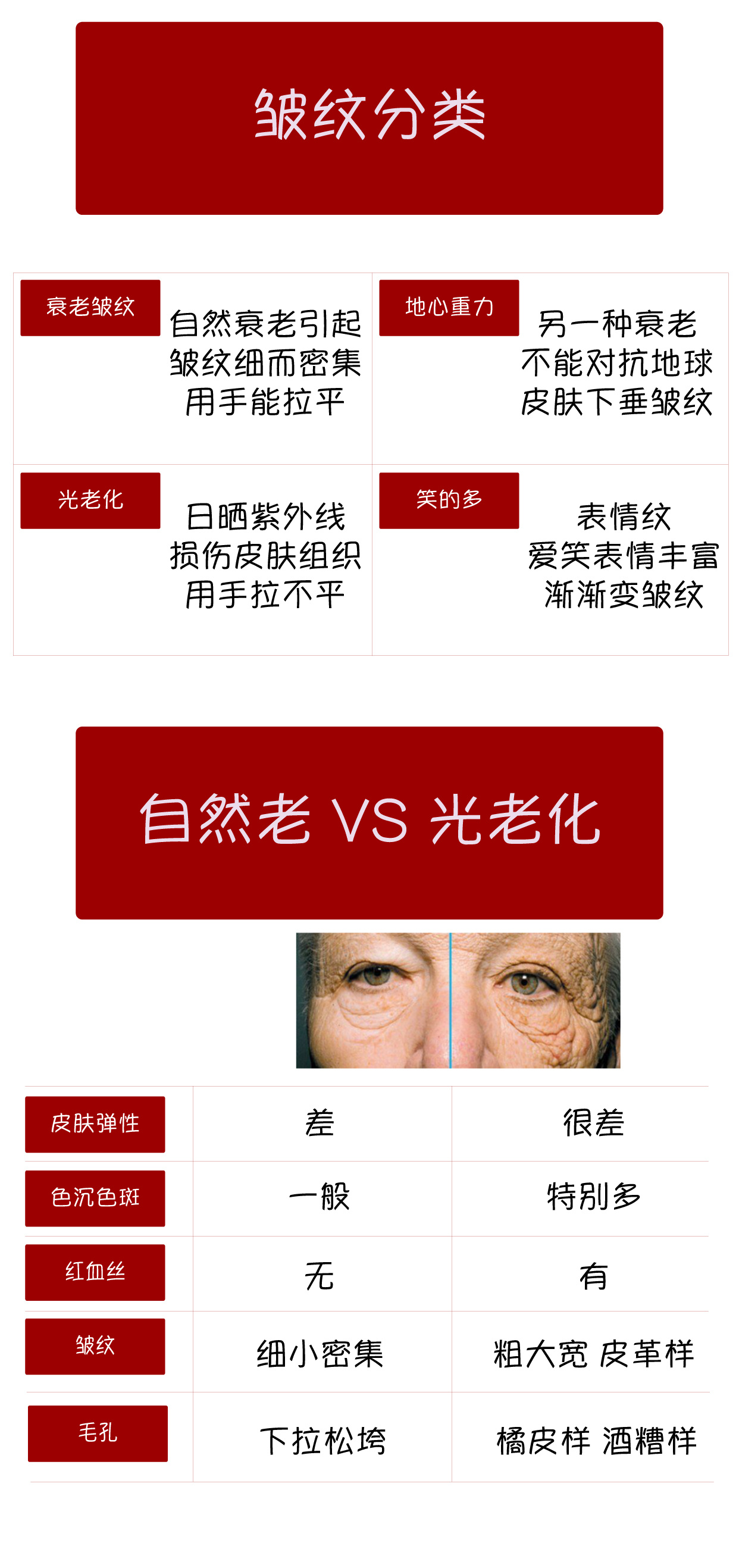 女大学生泪沟黑眼圈用什么眼霜,眼霜能去脂肪粒吗