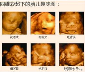 大排畸检查小孩不配合怎么办,大排畸检查胎儿不配合翻身怎么办