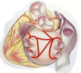 房颤患者是保守治疗还是积极治疗,房颤最主要的治疗是控制心率吗