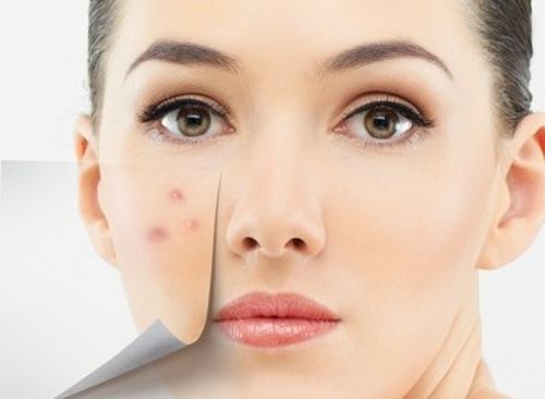 女人外面长什么痘，里面就有什么病！你造吗？