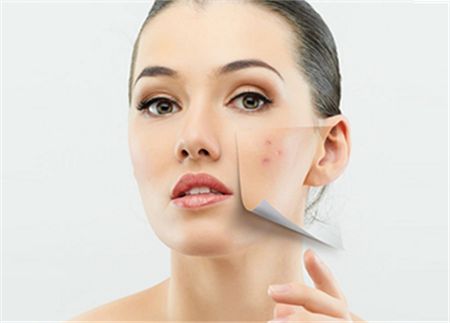 女性外面长了小痘,外面长什么痘里面就有什么病