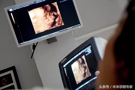 产后42天检查是挂哪个科,产后42天检查可以报销吗