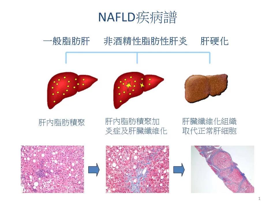喜欢喝酒的人如何克服,喜欢喝酒的人饮食如何调理