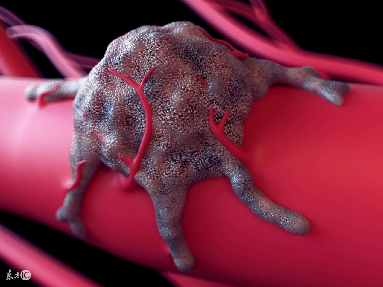 当今肿瘤的诊断和治疗方法,目前肿瘤治疗的几大方法