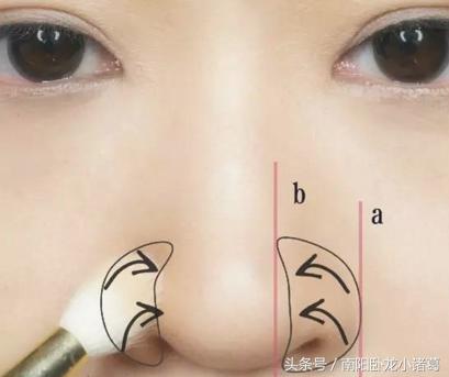 南阳时光整形除皱术,南阳时光假体隆鼻