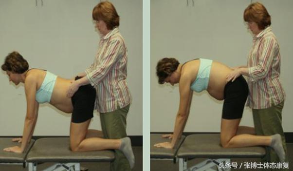 运动耻骨痛吃什么药,孕期运动操缓解盆骨疼