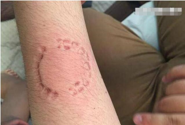 有效的排压方法,最有效的排压方式