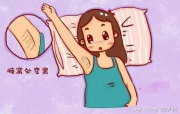 怀孕后孕妈哪些地方变黑,孕期身体发育变黑的征兆