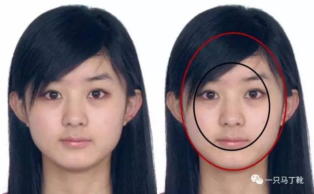 脸显宽怎么改善,怎样改善大小脸和方脸