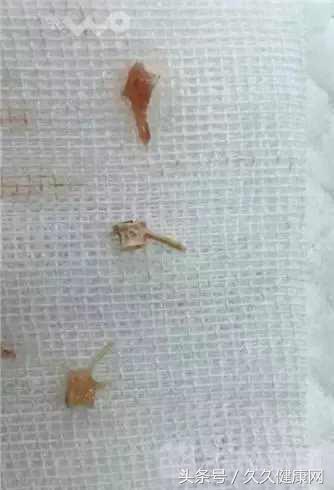 1岁5个月宝宝咳嗽肺炎为什么缺氧,1岁小孩咳嗽两天了肺炎怎么办