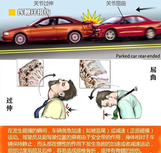 发生车祸时那些人是怎么死的?