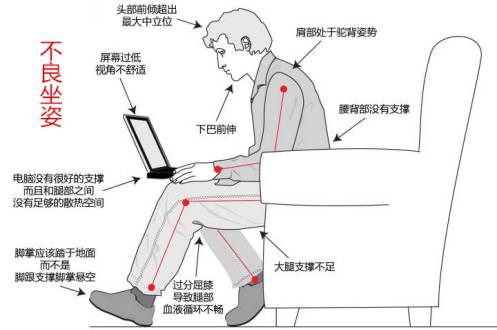 你的屁屁是真的蜜桃臀？还是骨盆前倾的伪翘臀？