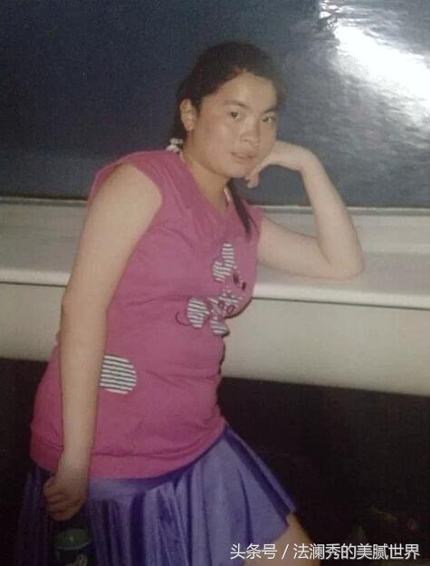 祛斑成功堪比整容,激光祛斑显老